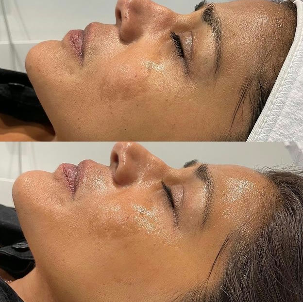 Professionell hudanalys hos Beauty & Lifestyle i Malmö