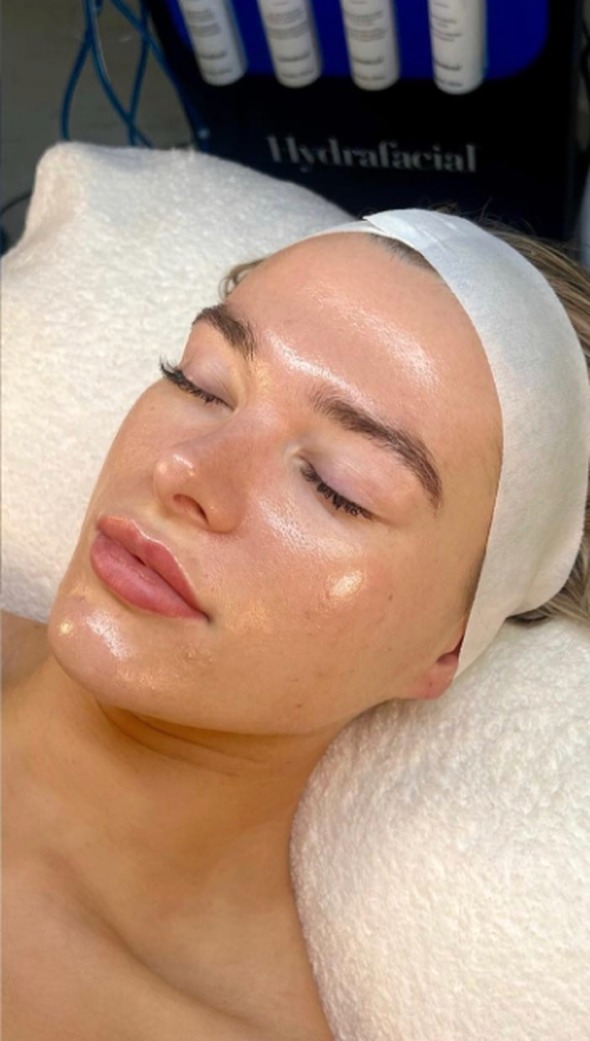 Lugn, hydrerad hud direkt efter en anpassad ansiktsbehandling hos Beauty & Lifestyle i Malmö