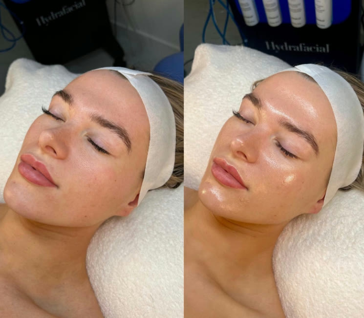 Avancerade ansiktsbehandlingar hos Beauty & Lifestyle i Malmö