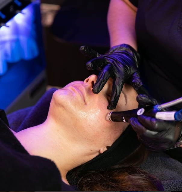 Dermapen® microneedling hos Beauty & Lifestyle i Malmö